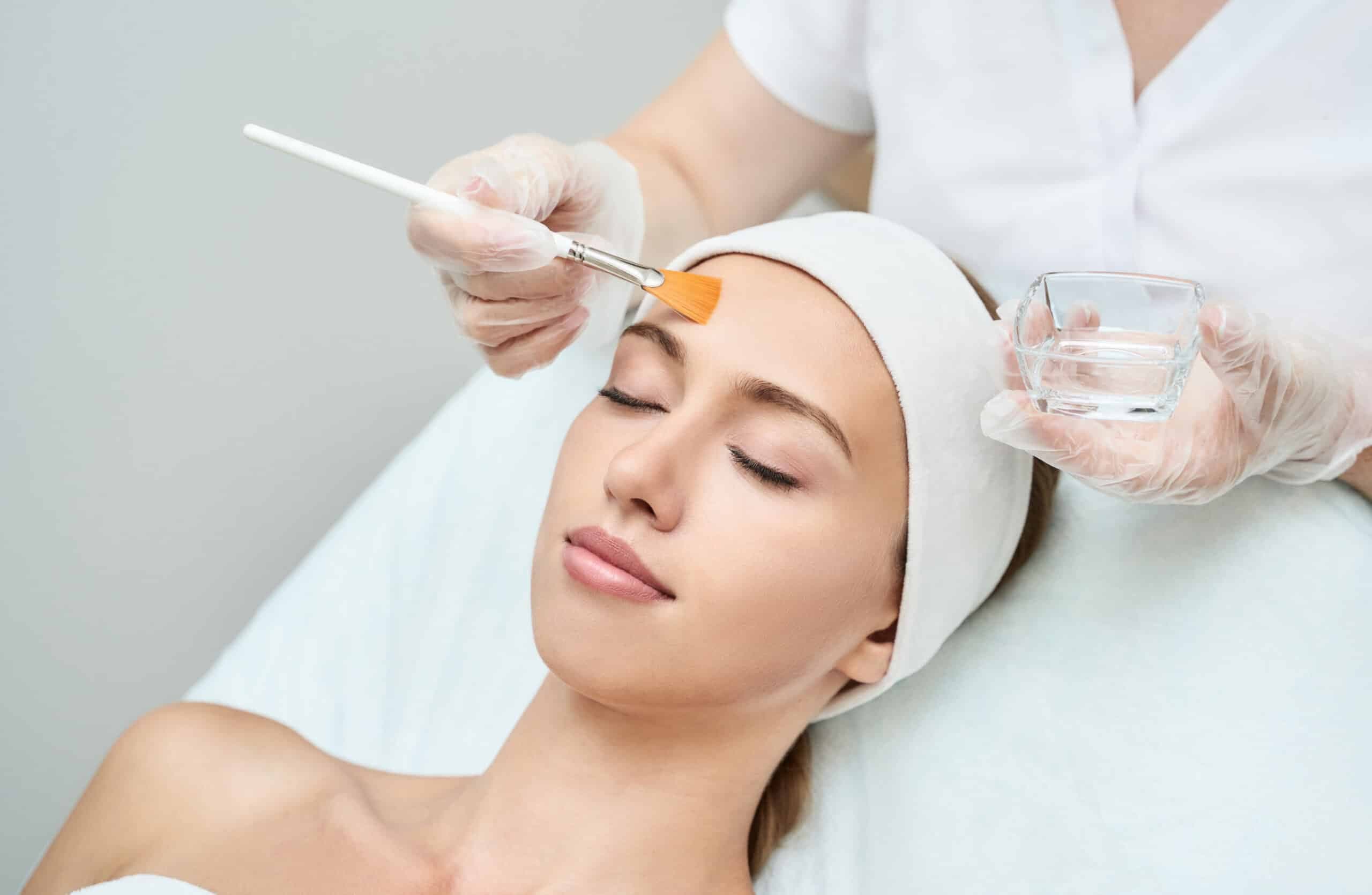 Chemical Peels