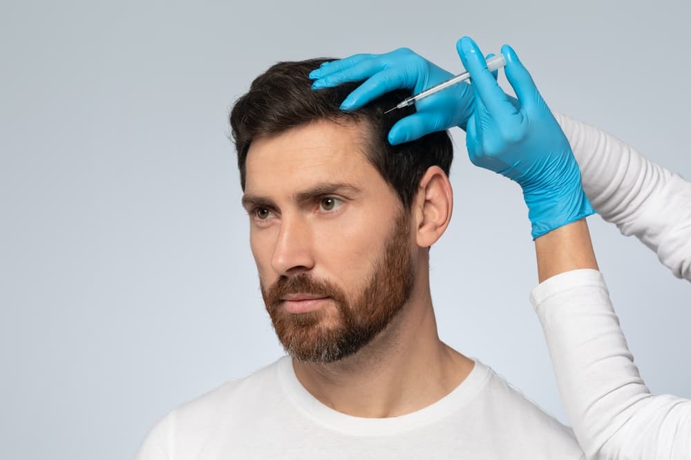 What Is PRP Hair Treatment?