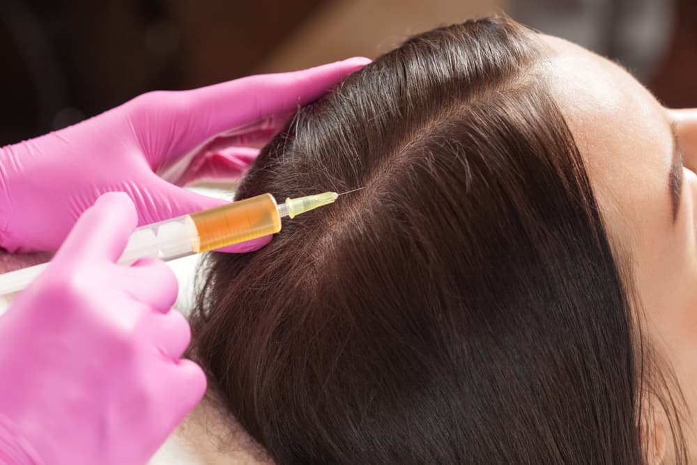 How Does PRP Hair Treatment Work?
