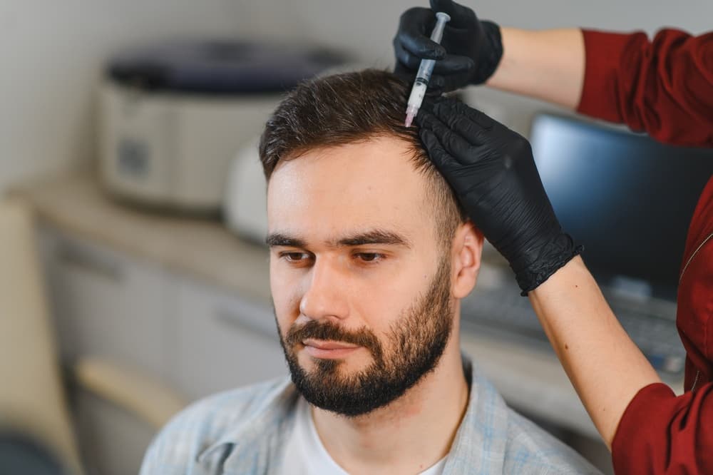 What Is Hair Mesotherapy?