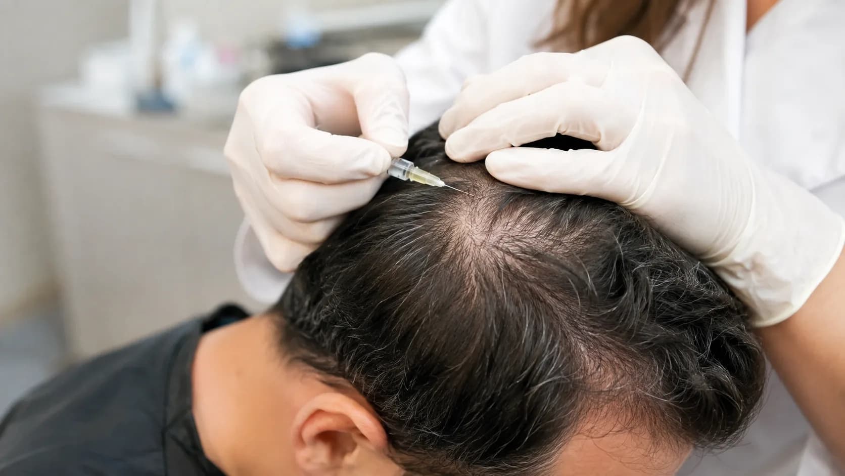 Hair Mesotherapy for Hair Thinning: How Does It Work?