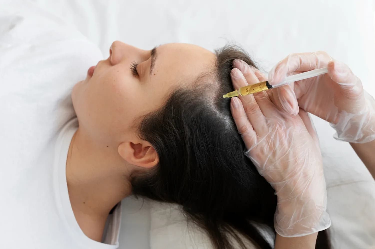 Hair Mesotherapy Benefits