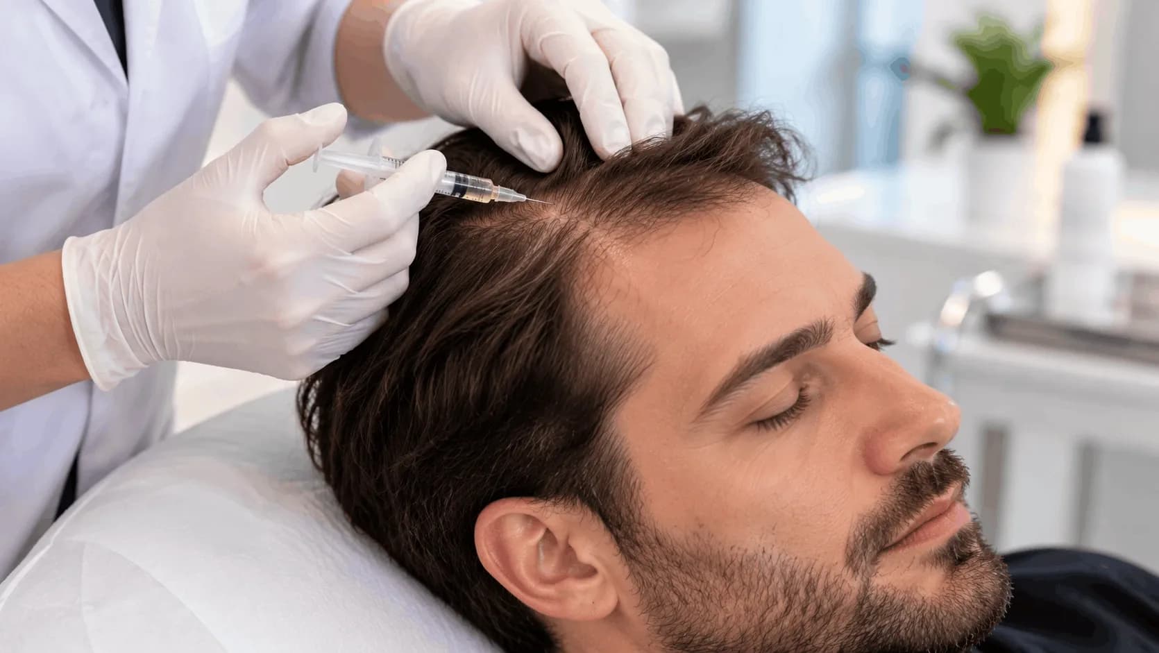 What Is Exosome Therapy for Alopecia and Can It Regrow Hair?
