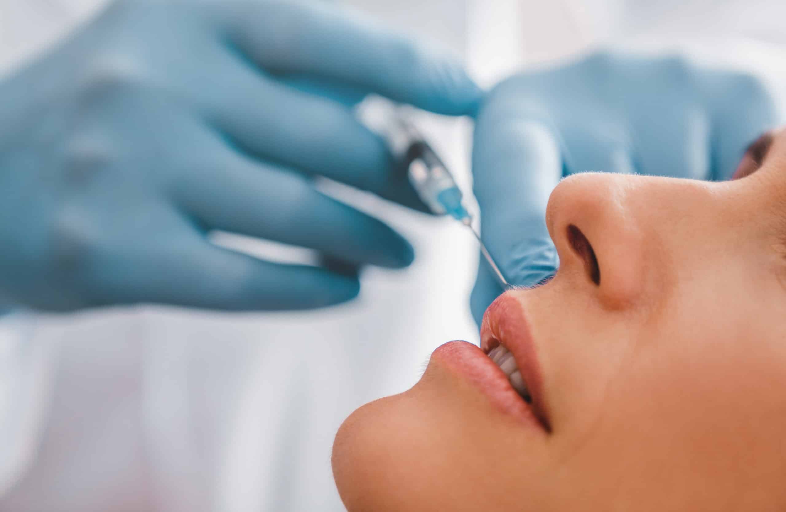 Dermal Fillers